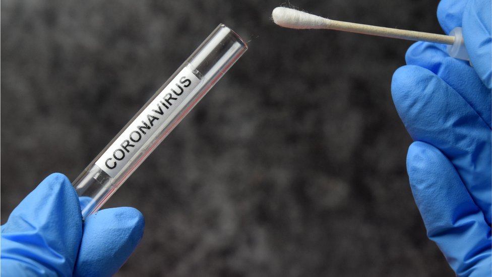 Coronavirus swab test